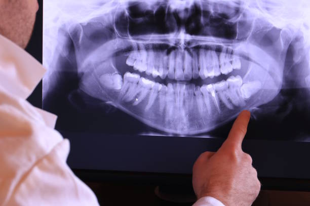 Best Pediatric Emergency Dentist in Sunset, LA