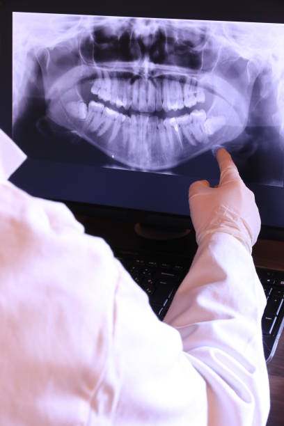 Best Emergency Dental Care for Broken or Chipped Teeth in Sunset, LA