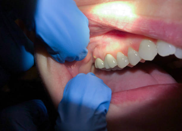 Best Emergency TMJ Treatment in Sunset, LA